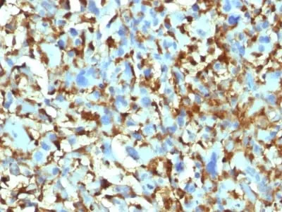 Anti-Factor XIIIa (Coagulation Factor XIIIA Chain) (F13A1/1448) - image 1