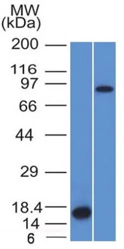 Anti-Factor XIIIa (Coagulation Factor XIIIA Chain) (F13A1/1448) - image 2