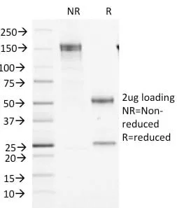 Anti-Factor XIIIa (Coagulation Factor XIIIA Chain) (F13A1/1448) - image 3