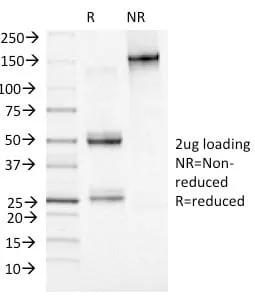 Anti-MCM7 (Proliferation Marker) (MCM7/1469) - image 2