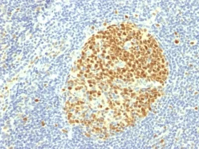 Anti-MCM7 (Proliferation Marker) (MCM7/1469) - image 1