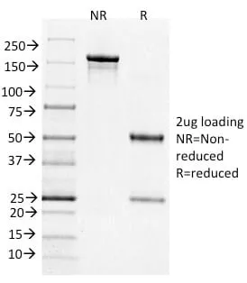 Anti-Bcl-6 (Follicular Lymphoma Marker) (BCL6/1526) - image 2