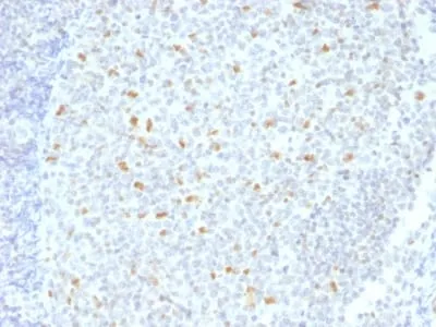 Anti-Bcl-6 (Follicular Lymphoma Marker) (BCL6/1526) - image 1