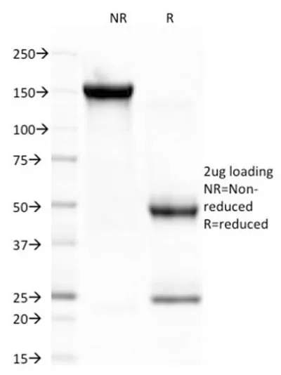 Anti-CELA3B / ELA3B (Pancreatic Function Marker) (CELA3B/1757) - image 2