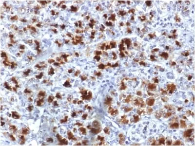 Anti-CELA3B / ELA3B (Pancreatic Function Marker) (CELA3B/1757) - image 1