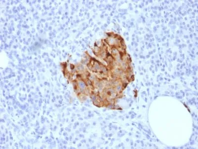 Anti-Chromogranin A / CHGA (Neuroendocrine Marker) (CHGA/1773R) - image 1