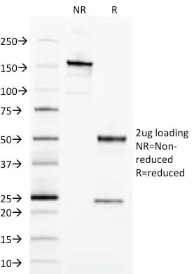 Anti-Ep-CAM / CD326 (Extracellular Domain) (Epithelial Marker) (EGP40/1798) - image 5