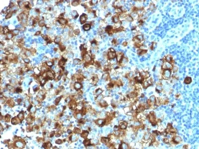 Anti-gp100 / Melanosome / PMEL17 / SILV (Melanoma Marker) (PMEL/1825R) - image 1