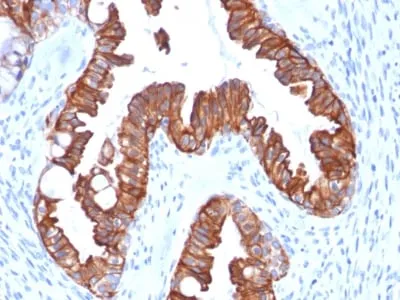 Anti-Cytokeratin 7 (Glandular and Transitional Epithelial Marker) (rOV-TL12/30) - image 1