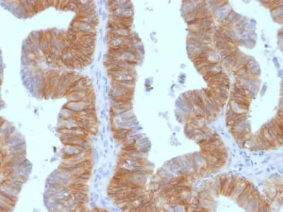 Anti-Ep-CAM / CD326 (Extracellular Domain) (Epithelial Marker) (EGP40/1384) - image 2
