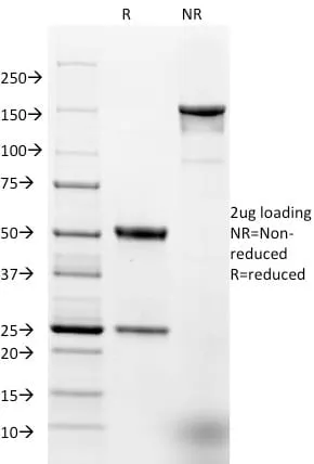 Anti-Ep-CAM / CD326 (Extracellular Domain) (Epithelial Marker) (EGP40/1384) - image 1