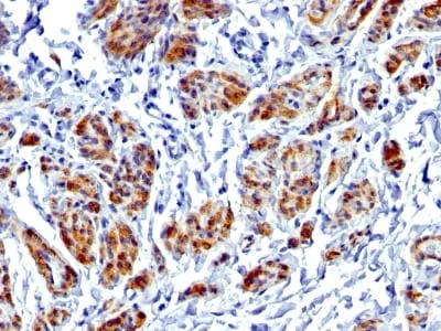 Anti-Caldesmon, HMW (h-Caldesmon) (Smooth Muscle Marker) (CALD1/1424R) - image 1