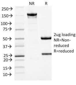 Anti-MCM7 (Proliferation Marker) (MCM7/1467) - image 2
