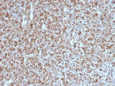 Anti-Bcl-6 (Follicular Lymphoma Marker) (BCL6/1527) - image 2