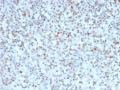 Anti-Bcl-6 (Follicular Lymphoma Marker) (BCL6/1527) - image 3