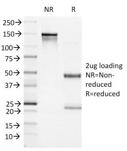 Anti-Bcl-6 (Follicular Lymphoma Marker) (BCL6/1527) - image 4