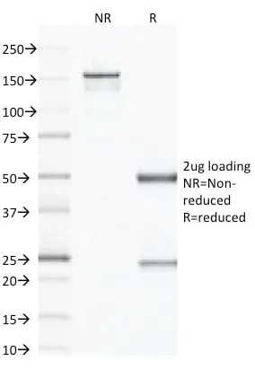 Anti-Factor XIIIa (Coagulation Factor XIIIA Chain) (F13A1/1683) - image 2