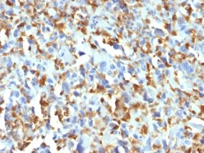 Anti-Factor XIIIa (Coagulation Factor XIIIA Chain) (F13A1/1683) - image 1