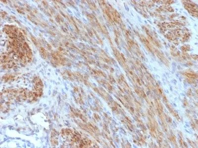 Anti-Desmin (Muscle Cell Marker) (DES/1711) - image 1