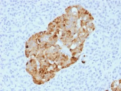 Anti-Chromogranin A / CHGA (Neuroendocrine Marker) (CHGA/1731R) - image 1