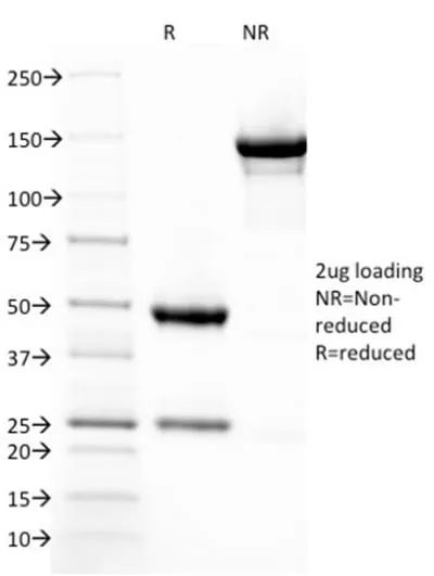 Anti-Thrombomodulin / CD141 (Endothelial Cell Marker) (THBD/1782) - image 3