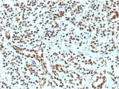 Anti-Histone H1 (Nuclear Marker) (HH1/1784R) - image 1