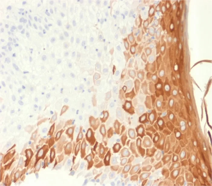 Anti-Cytokeratin 10 (Suprabasal Epithelial Marker) (rKRT10/1275) - image 1