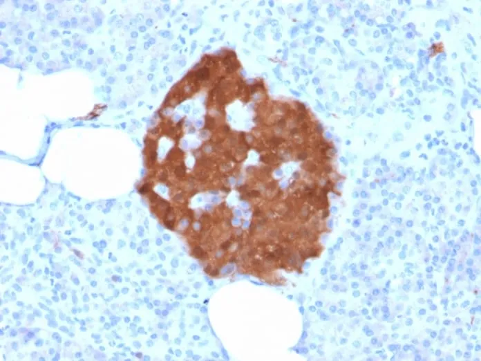 Anti-PGP9.5 / UchL1 (pan-Neuronal Marker) (rUCHL1/775) - image 5