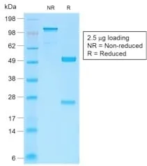 Anti-Catenin, beta (CTNNB1) (CTNNB1/2030R) - image 4