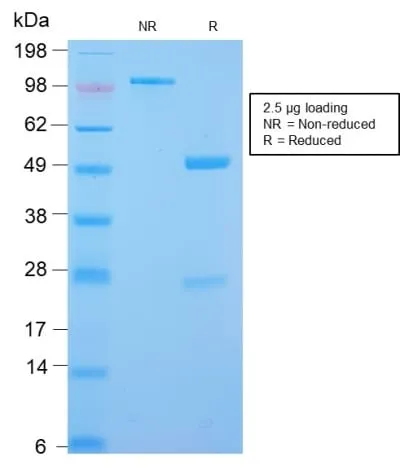 Anti-Desmin (Muscle Cell Marker) (DES/2960R) - image 2