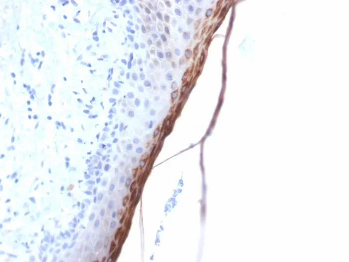 Anti-Filaggrin (Keratinocyte Differentiation Marker) (FLG/1957R) - image 1