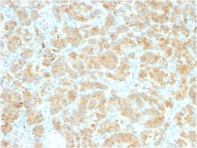 Anti-GP2 (Glycoprotein 2) / ZAP75 (GP2/2569R) - image 1