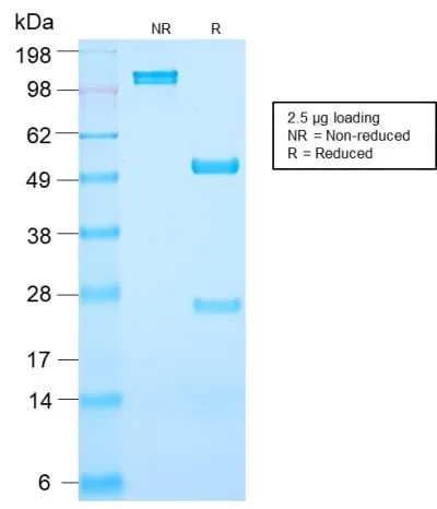 Anti-Prostate Specific Antigen (PSA) (KLK3/2871R) - image 2