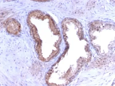Anti-Prostate Specific Antigen (PSA) (KLK3/2871R) - image 1