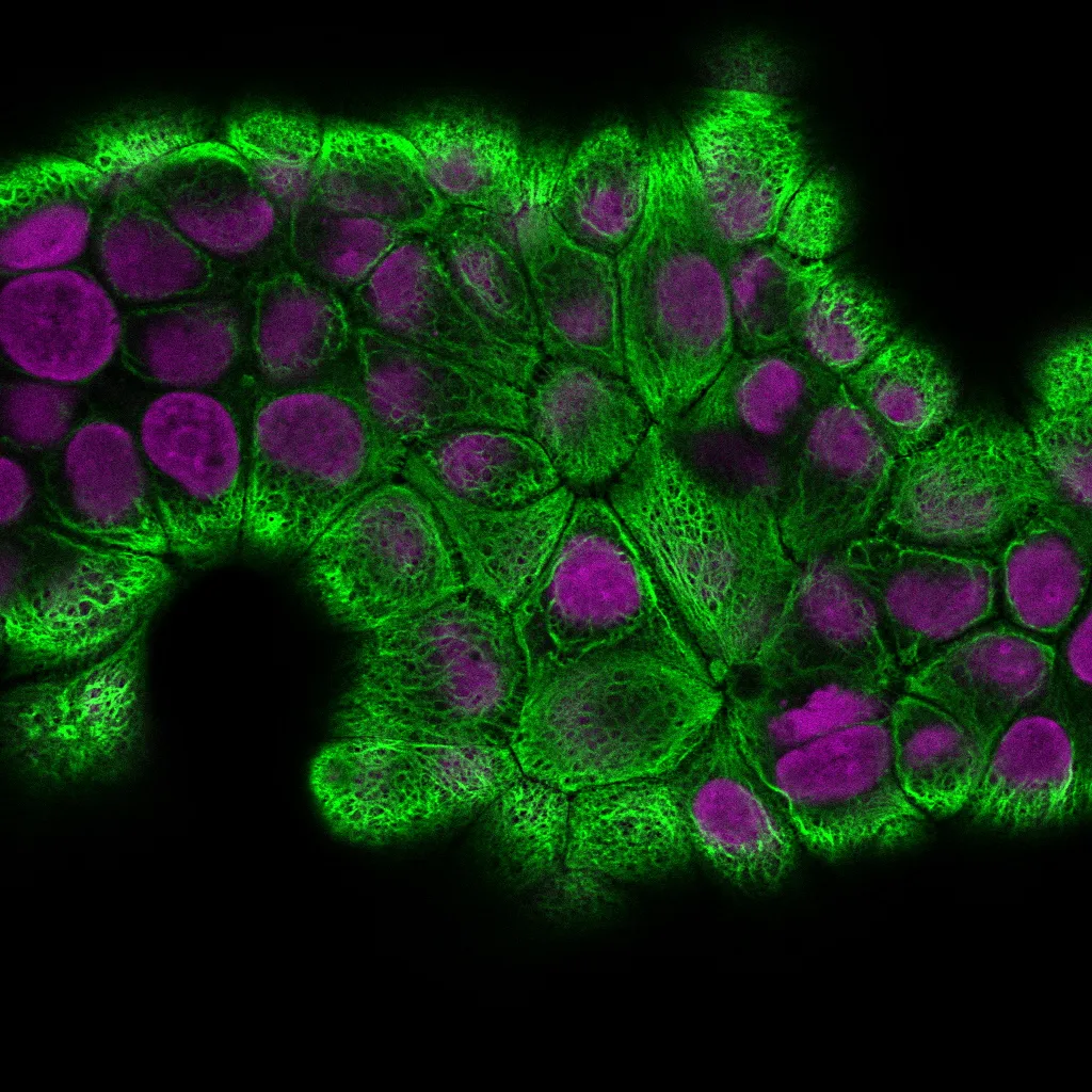 Anti-Cytokeratin 18 (KRT18) (KRT18/2808R) - image 2