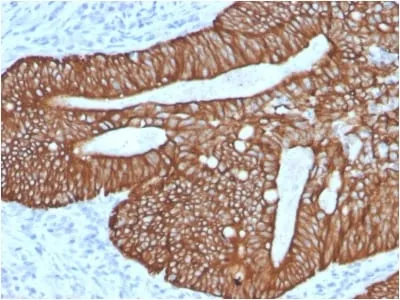 Anti-Cytokeratin 18 (KRT18) (KRT18/2808R) - image 5