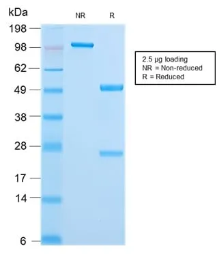 Anti-Cytokeratin 18 (KRT18) (KRT18/2808R) - image 7