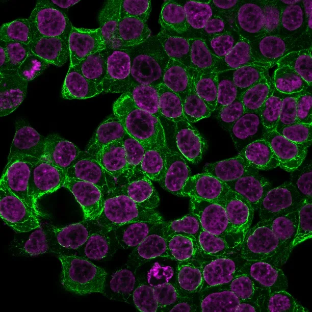 Anti-Cytokeratin 18 (KRT18) (KRT18/2808R) - image 1