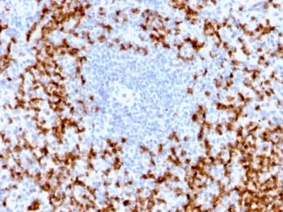 Anti-MMP9 (MMP9/2025R) - image 1