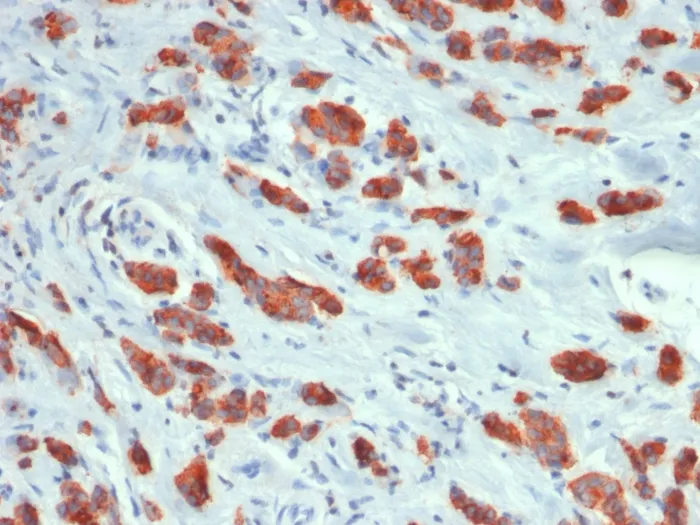 Anti-MUC1 / CA15-3 / EMA / CD227 (Epithelial Marker) (MUC1/1887R) - image 1