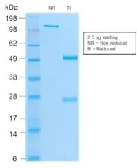 Anti-MyoD1 (Rhabdomyosarcoma Marker) (MYOD1/2075R) - image 2