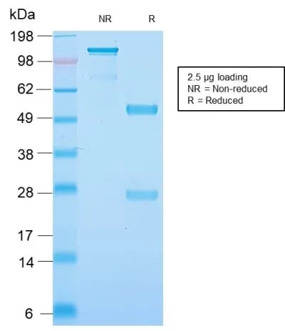 Anti-Neurofilament (NF-H) (Neuronal Marker) (NEFL.H/2324R) - image 2