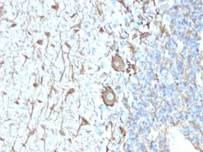 Anti-Neurofilament (NF-H) (Neuronal Marker) (NEFL.H/2324R) - image 1