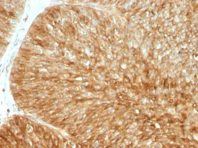 Anti-Beta-2 Microglobulin (Renal Failure & Tumor Marker) (B2M/1857R) - image 1