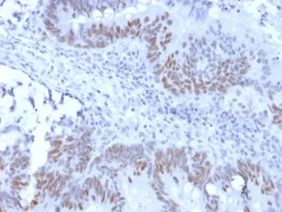 Anti-Rb1 (Tumor Suppressor Protein) (RB1/2313R) - image 1