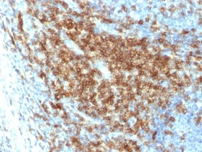 Anti-CD43 (T-Cell Marker) (SPN/2049R) - image 3
