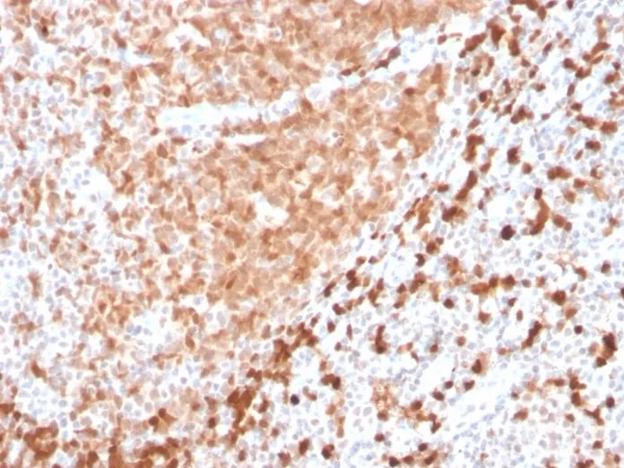 Anti-TCL1 (T-Cell Marker) (TCL1/2747R) - image 2