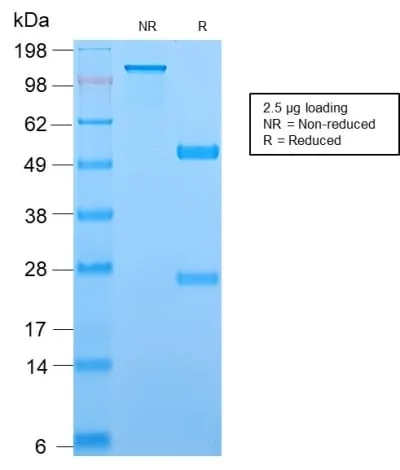 Anti-TCL1 (T-Cell Marker) (TCL1/2747R) - image 3
