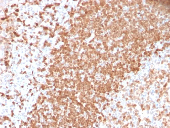 Anti-TCL1 (T-Cell Marker) (TCL1/2747R) - image 1