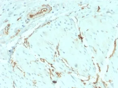 Anti-CD34 (Hematopoietic Stem Cell & Endothelial Marker) (HPCA1/2598R) - image 4